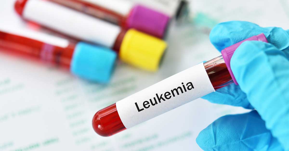 Leukemia Blood Sample
