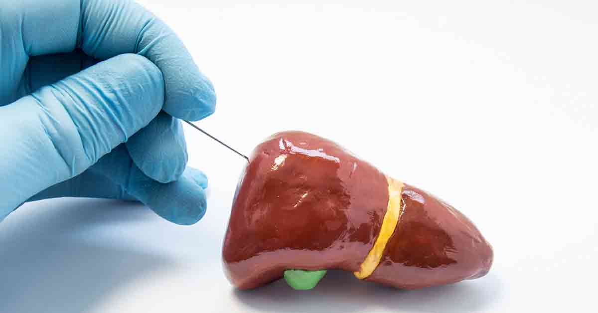 Example of liver biopsy