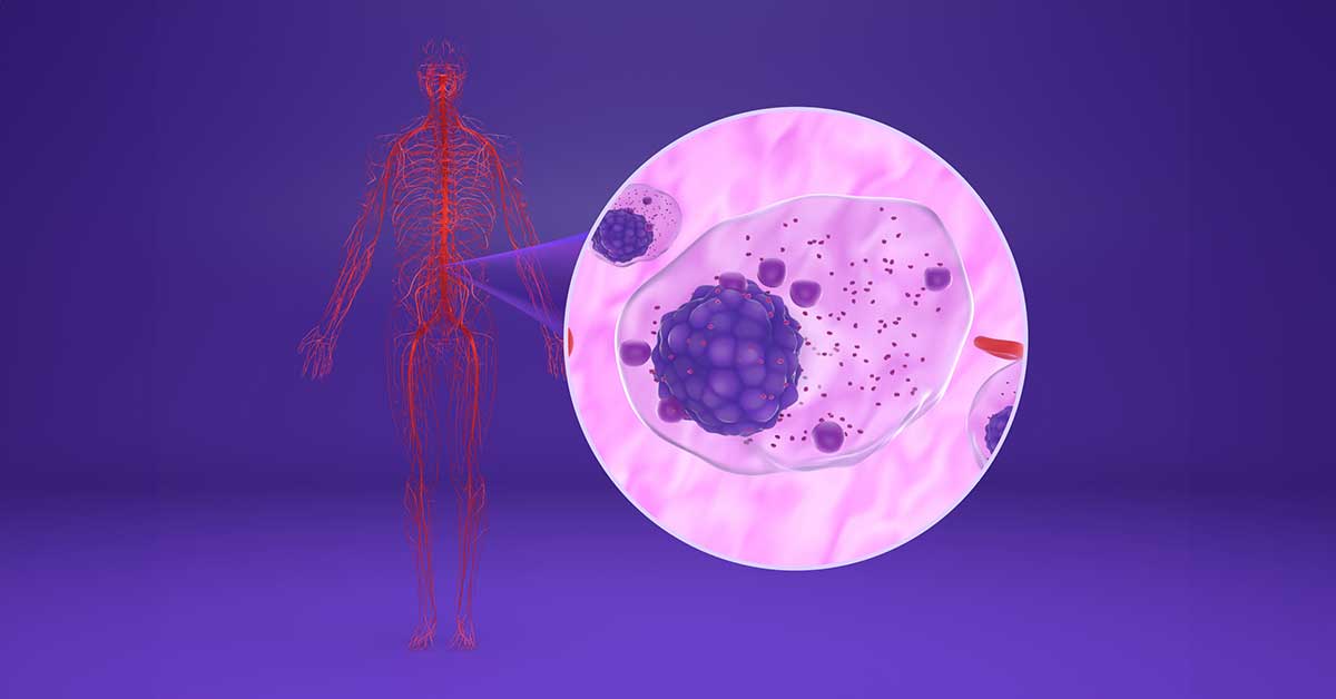 Multiple myeloma (MM) cells in the blood flow - isometric view 3d illustration