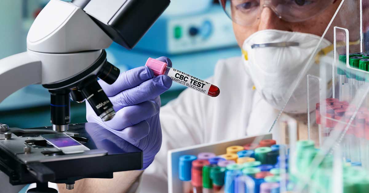 cbc blood test